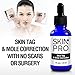 SkinPro Skin Tag Remover & Mole Corrector | Medical Grade Formula with 17% Salicylic Acid | Rapid Excess Skin Removal | Extra Strength Solutionthumb 3