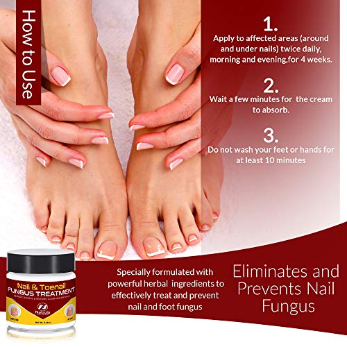 image for Natrulo Nail & Toenail Fungus Treatment - Herbal Anti Fungal Cream wit