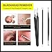 Wishesport Blackhead Remover,Pimple Comedone Extractor, Blackhead Removal tool, Blemish Acne Zit Remover Tweezer Kit,6 Piece black