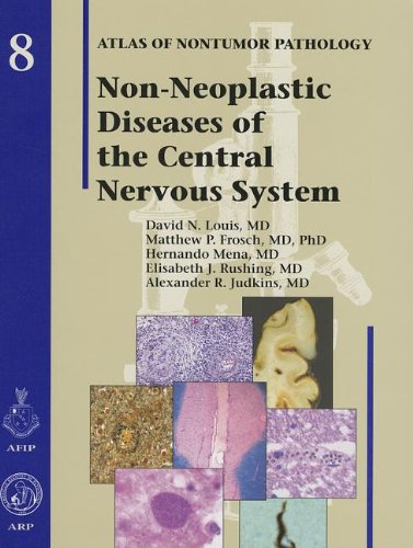 Non-Neoplastic Diseases of the Central Nervous System (Atlas of Nontumor Pathology, First Series Fascicle) Non-Neoplastic Diseases of the Central Nervous System (Atlas of Nontumor Pathology, First Series Fascicle)