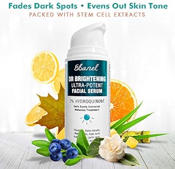 hydroquinone for melasma