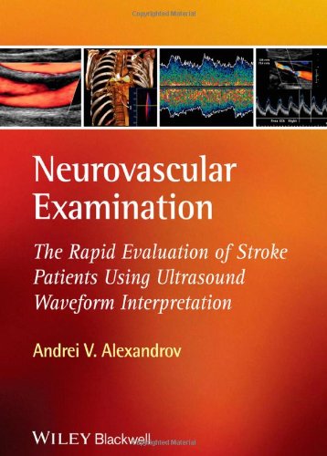 Neurovascular Examination: The Rapid Evaluation of  Stroke Using Ultrasound Waveform Interpretation
