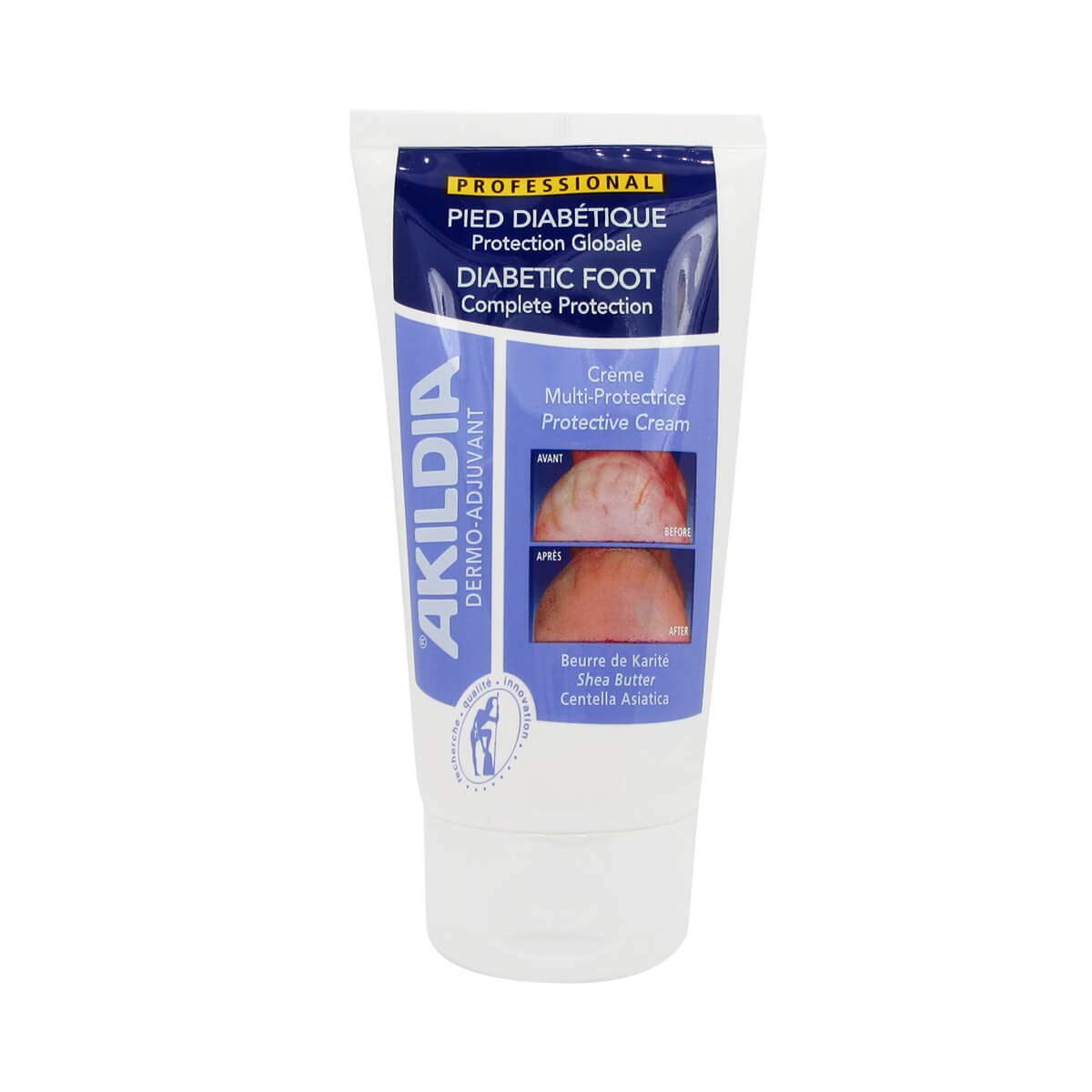 Akildia Diabetic Foot Protector Cream 150ml