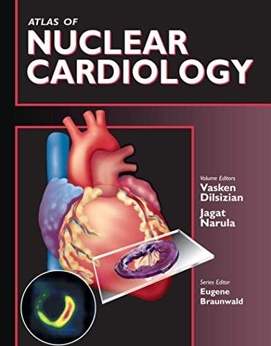 The EACVI Handbook of Nuclear Cardiology (The European Society of
