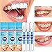 Teeth Whitening Pen, Safe 35% Carbamide Peroxide Gel, 20+ Uses, Painless, No Sensitivity, Easy to Use, Natural Mint Flavor