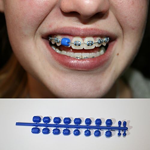 Cheeksaver Protection for Braces Orthodontic Mouth Guard Dental Teeth (Blue)