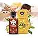 Dragon Honor NEW Lymphatic Drainage Ginger Oil [ 100% PURE Natural ] 30ml