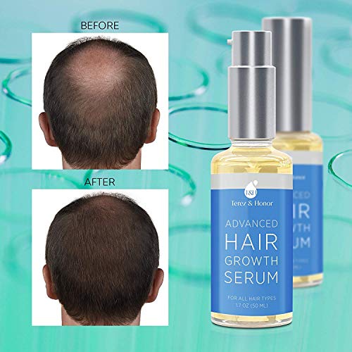 Hair Growth Serum for Thicker Longer Fuller Healthier Hair, Help hair follicle growth,Prevent Hair Loss & Thinning, With Natural Vitamin Rich Treatment, All Hair Types