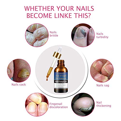 Nail Treatment,Repair Toenails,Nail Repair Solution, Nail Treatment Care for Nails and Cuticles - Thumbnail 2