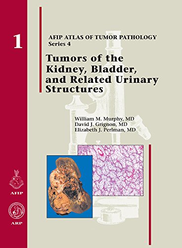 Tumors of the Kidney, Bladder and Related Urinary Structures 2004 (AFIP Atlas of Tumor Pathology 4th - //medicalbooks.filipinodoctors.org