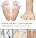 Metatarsal Pads Toe Separators Ball of Foot Cushions- Soft Gel Ball of Foot Pads – Mortons Neuroma Callus Metatarsal Foot Pain Relief Bunion Forefoot Cushioning Relief Women Menthumb 3