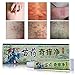 2 PCS Psoriasis Cream, Psoriasis Treatment Cream, Foot Cream, Natural Chinese Herbal Eczema Ointment