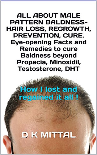 Amazon Com All About Male Pattern Baldness Hair Loss Regrowth