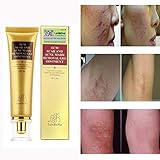 Scar and Acne Spots Mark Removal Gel Cream Face Care Acne Treatment Whitening Moisturizing Facial Cream 30ml