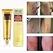 Scar and Acne Spots Mark Removal Gel Cream Face Care Acne Treatment Whitening Moisturizing Facial Cream 30ml