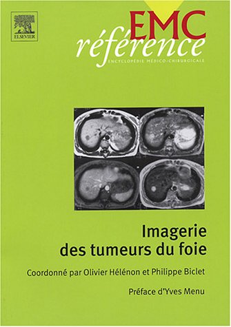Imagerie des tumeurs du foie