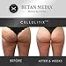 Betan MediX Proven by Plastic Surgeons: Cellulite Cream and Massager - CellulitiX