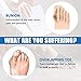 (4pcs) Bunion Relief Sleeve,Bunion Corrector with Soft Gel Pads REUSEABLE Bunion Splints Toe Spacer Socks Great for Hammer Toe,Hallux Valgus & Big Toe Joint, for Men and Women-Large/X-Large.