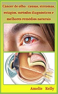 Livro Câncer de olho - causas, sintomas, estágios, métodos diagnósticos e melhores remédios naturais