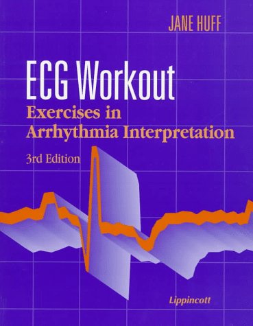 Ecg Workout: Exercises in Arrhythmia Interpretation