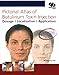 Pictorial Atlas of Botulinum Toxin Injection: Dosage, Localization, Application by 