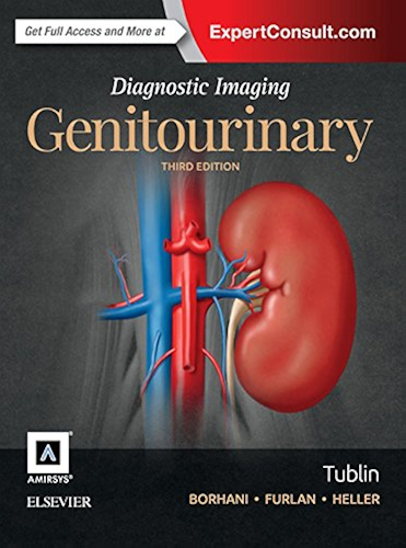 Download Diagnostic Imaging: Genitourinary E-Book (English Edition) PDF