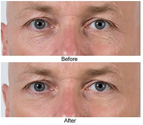 good face wash for blemishes