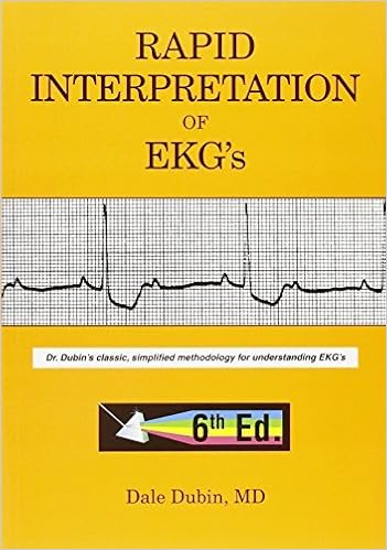 rapid-interpretation-of-ekg's-book