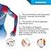 Velpeau Arm Sling with Waist Strap - Can Be Used During Sleep - Shoulder & Rotator Cuff Support - Adjustable Medical Sling for Subluxation, Dislocation, Sprains, Strains & Tears (Large)