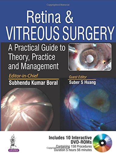 Retina & Vitreous Surgery: A Practical Guide to Theory, Practice and Management