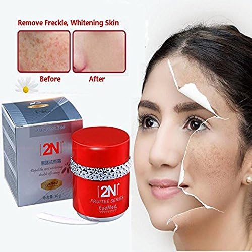 Freckle Cream, Face Moisturizer, Skin Lightening Cream, Freckle Remover For Remove Spot and Melanin + Moisturizing Firming Skin