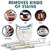 Teeth Whitening Kit, LED Light, 35% Carbamide Peroxide, (3) 3ml Gel Syringes, Tray and Case