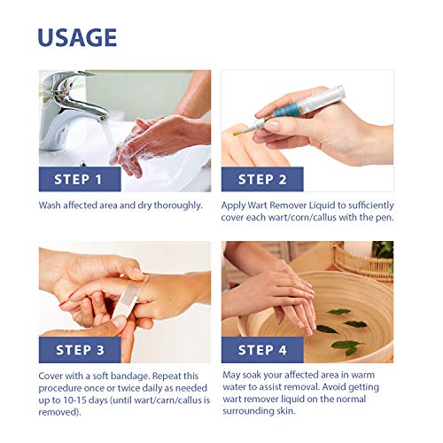 ST. Mege Wart Pen - Maximum Strength - Wart Pen for Flat Warts, Plantar Warts, Common Warts - Corn, Callus - Lightweight - Easy-to-Use - Travel-Friendly
