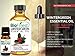 Biofinest Wintergreen Oil - 100% Pure Wintergreen Essential Oil - Premium Organic - Therapeutic Grade - Aromatherapy - Boost Digestion - Strengthen Muscle - FREE E-Book (10ml)