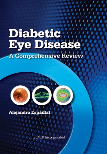 DIABETIC EYE DISEASE
