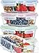 Glass Meal Prep Containers 3 Compartment [3PC SET With 6x No-Spill Lids, BPA FREE] Lunch Containers/ Glass Food Storage Containers Microwave, Dishwasher AND OVEN SAFE. Bento Box Lunch Glass Container.