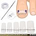 Ingrown Pincer Paronychia Toe Nail Straightening Correction Treatment Tool with Wire Brace Clamp 2 Piece Pedicure Set (See Instructions in Product Description)