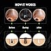 ffomo Blackhead Remover