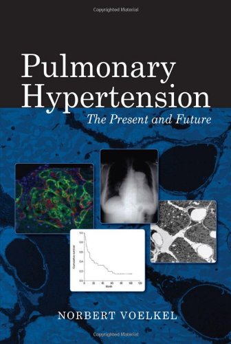 PULMONARY HYPERTENSION