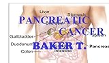 Pancreatic Cancer (WHAT YOU NEED TO KNOW Book 6)
