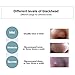 Blackhead Mask, LuckyFine - Blackhead Removal Facial Mask, Deep Cleansing Purifying Whitening Mud Mask, Black Peel-off Mask