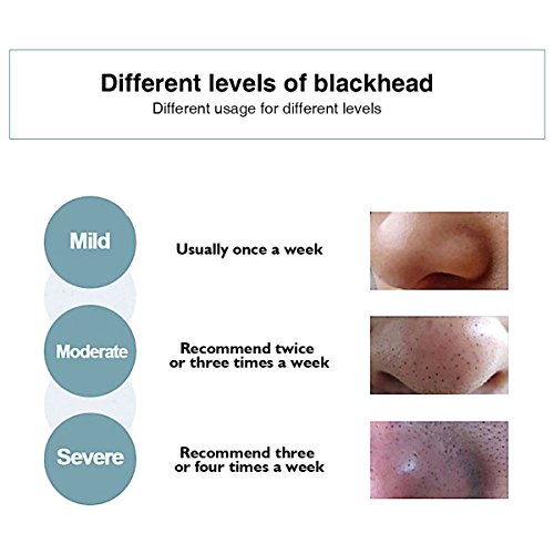 Blackhead Mask, LuckyFine - Blackhead Removal Facial Mask, Deep Cleansing Purifying Whitening Mud Mask, Black Peel-off Mask - Thumbnail 4