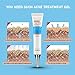 Acne Cleaning Cream,Acne Treatment Gel,Acne Removal Cream,Acne Gel Essence Skin Repair Face Cream,Natural Treatment Gel for Facial Blackhead Acne,Removes Spots Calms Inflammation