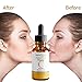 Dermaxgen 20% Vitamin C Serum + Hyaluronic Acid + Retinol + Vitamin E + Vitamin B PURE ORGANIC- Boost Skin Collagen, Moisturizer, Anti Aging & Wrinkle Facial Serum (1 FL OZ)
