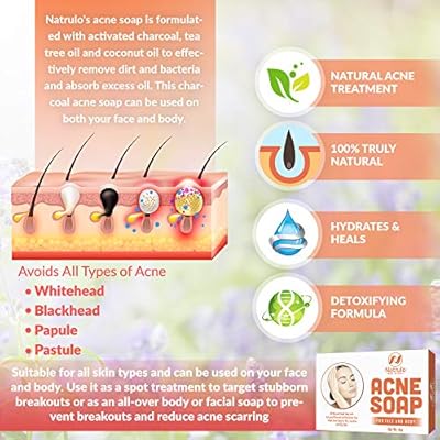 all natural acne treatment