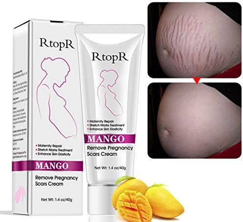 rtopr stretch mark cream