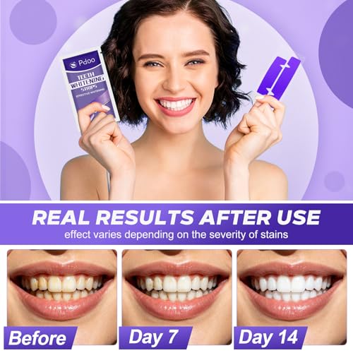 Purple Teeth Whitening Strips - 32 Teeth Whitener Strips (16 Uses) | Purple Color-Correcting Gel Technology | Teeth Whitening Kit for Sensitive Teeth | Enamel Safe, Peroxide-Free for a Brighter Smile