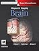 Diagnostic Imaging: Brain E-Book