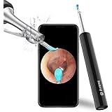 Ear Wax Removal Endoscope Otoscope, Earwax Remover Tools, Scope, with 1080P FHD Camera, 6 Led Lights, Wireless Connected…