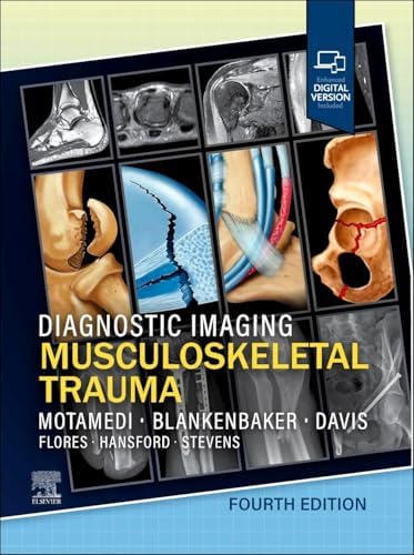 Diagnostic Imaging: Chest: 9780323796637: Medicine & Health